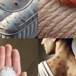 Male bube koje žive u vašem krevetu – Evo kako da ih izbacite zauvek uz ovaj jednostavan trik! Male bube koje žive u vašem krevetu – Evo kako da ih izbacite zauvek uz ovaj jednostavan trik! - featured image