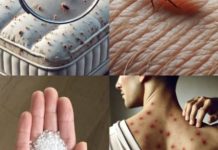 Male bube koje žive u vašem krevetu – Evo kako da ih izbacite zauvek uz ovaj jednostavan trik! Male bube koje žive u vašem krevetu – Evo kako da ih izbacite zauvek uz ovaj jednostavan trik! - featured image