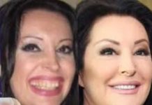 POGLEDAJTE kako su izgledale domaće ličnosti PRIJE UMJETNIH ZUBA – CECA JE HIT (FOTO)