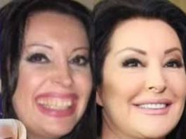 POGLEDAJTE kako su izgledale domaće ličnosti PRIJE UMJETNIH ZUBA – CECA JE HIT (FOTO)